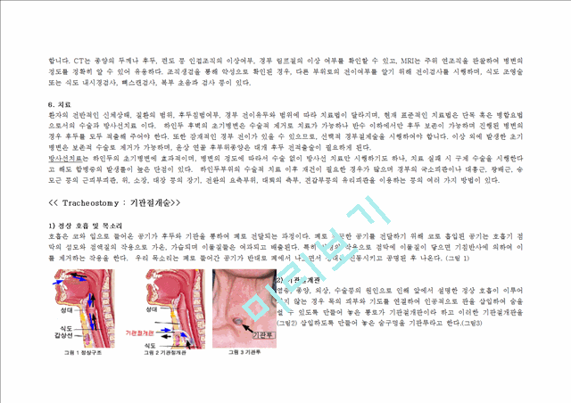 Case Study-Hypopharynx cancer   (3 )